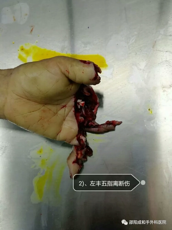 邵阳创伤骨科,邵阳风湿病区,邵阳骨质增生,邵阳关节病区,邵阳颈椎病区