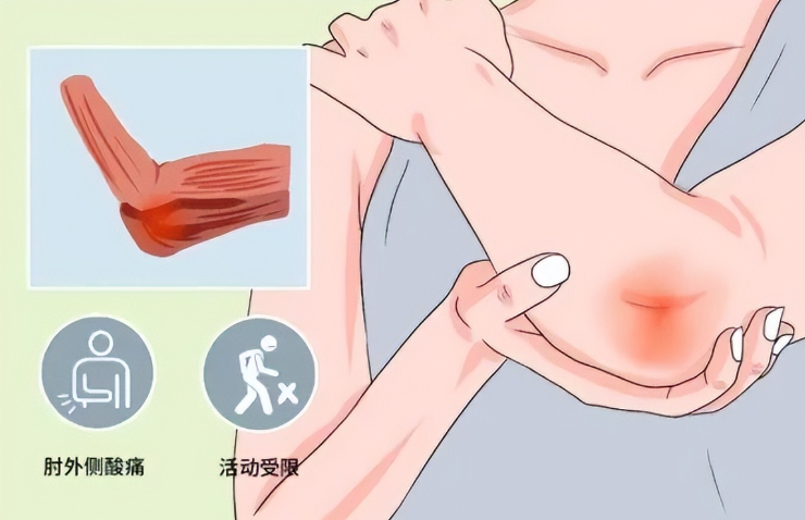 邵阳创伤骨科,邵阳风湿病区,邵阳骨质增生,邵阳关节病区,邵阳颈椎病区