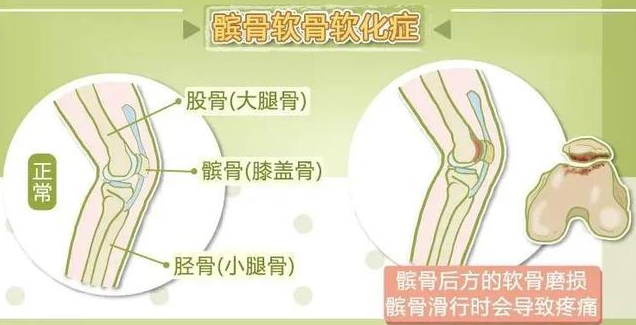 邵阳创伤骨科,邵阳风湿病区,邵阳骨质增生,邵阳关节病区,邵阳颈椎病区