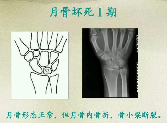 邵阳创伤骨科,邵阳风湿病区,邵阳骨质增生,邵阳关节病区,邵阳颈椎病区