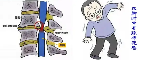 邵阳创伤骨科,邵阳风湿病区,邵阳骨质增生,邵阳关节病区,邵阳颈椎病区