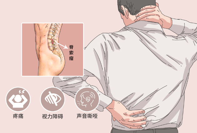 邵阳创伤骨科,邵阳风湿病区,邵阳骨质增生,邵阳关节病区,邵阳颈椎病区