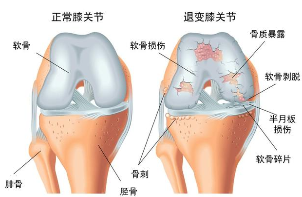 邵阳创伤骨科,邵阳风湿病区,邵阳骨质增生,邵阳关节病区,邵阳颈椎病区